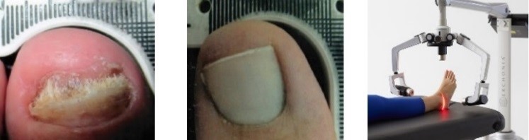 Lunula and FX635 Webinar Image 2