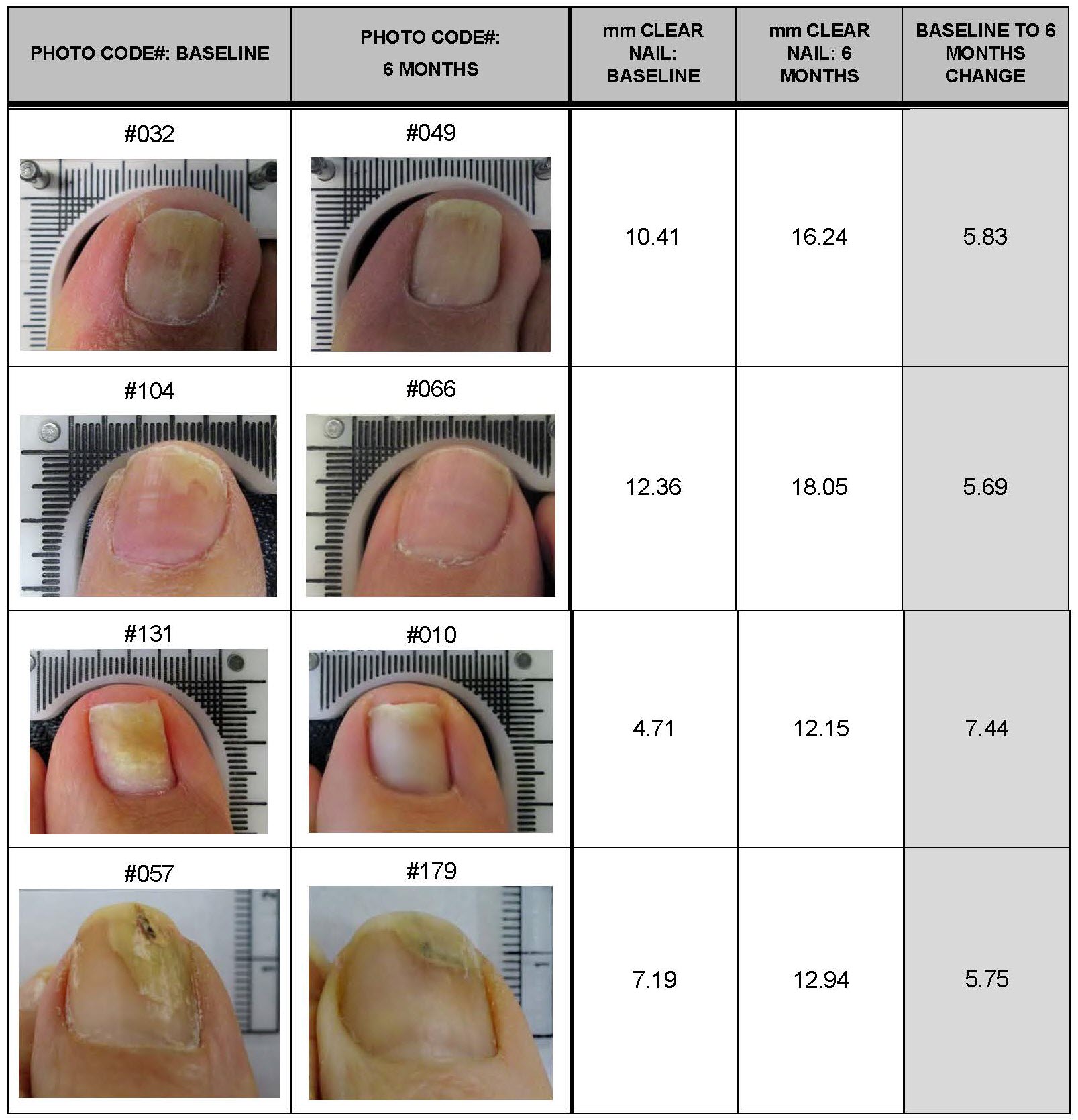 Lunula Clinical Results Summary for Press Release_Page_1