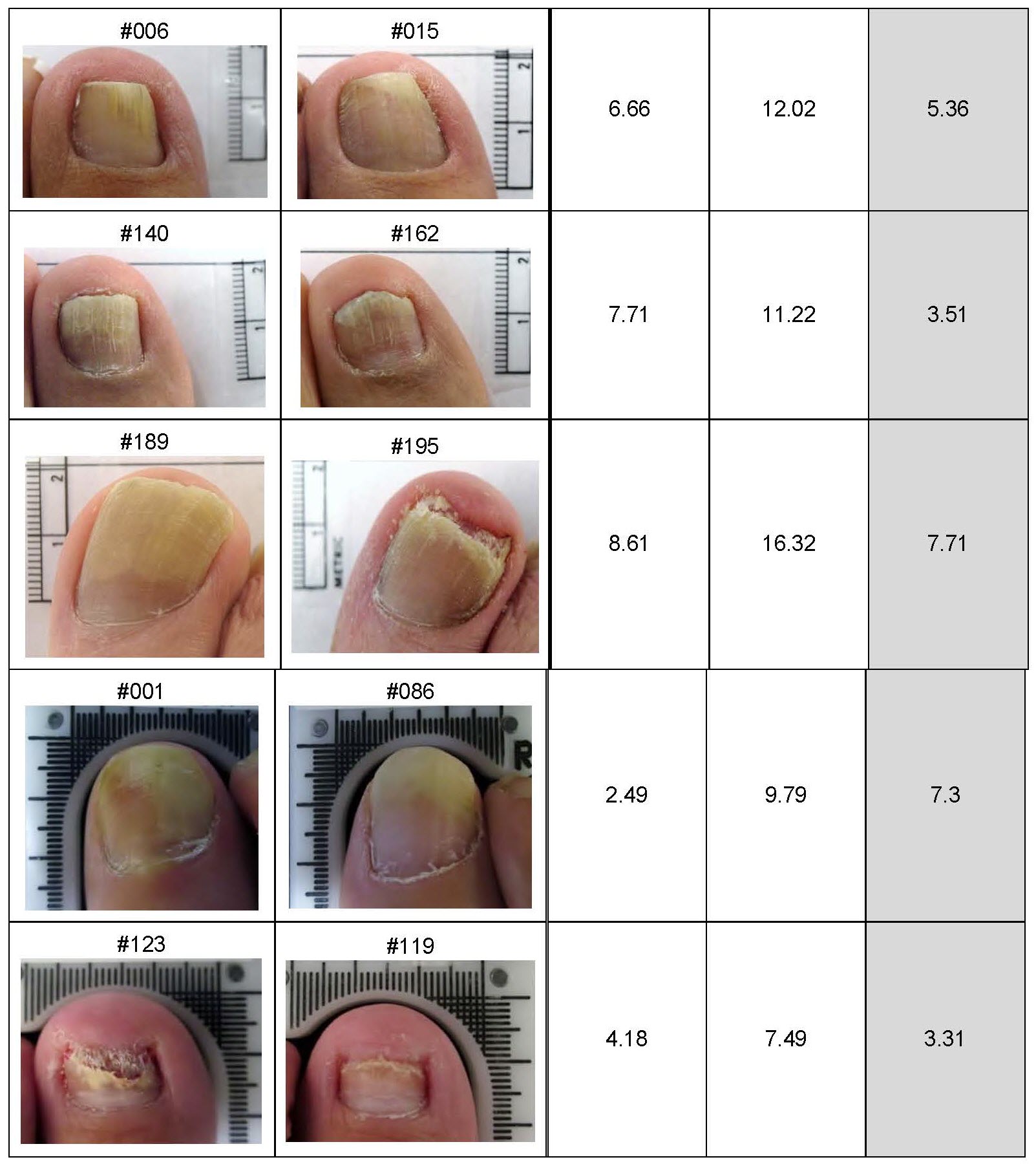 Lunula Clinical Results Summary for Press Release_Page_2