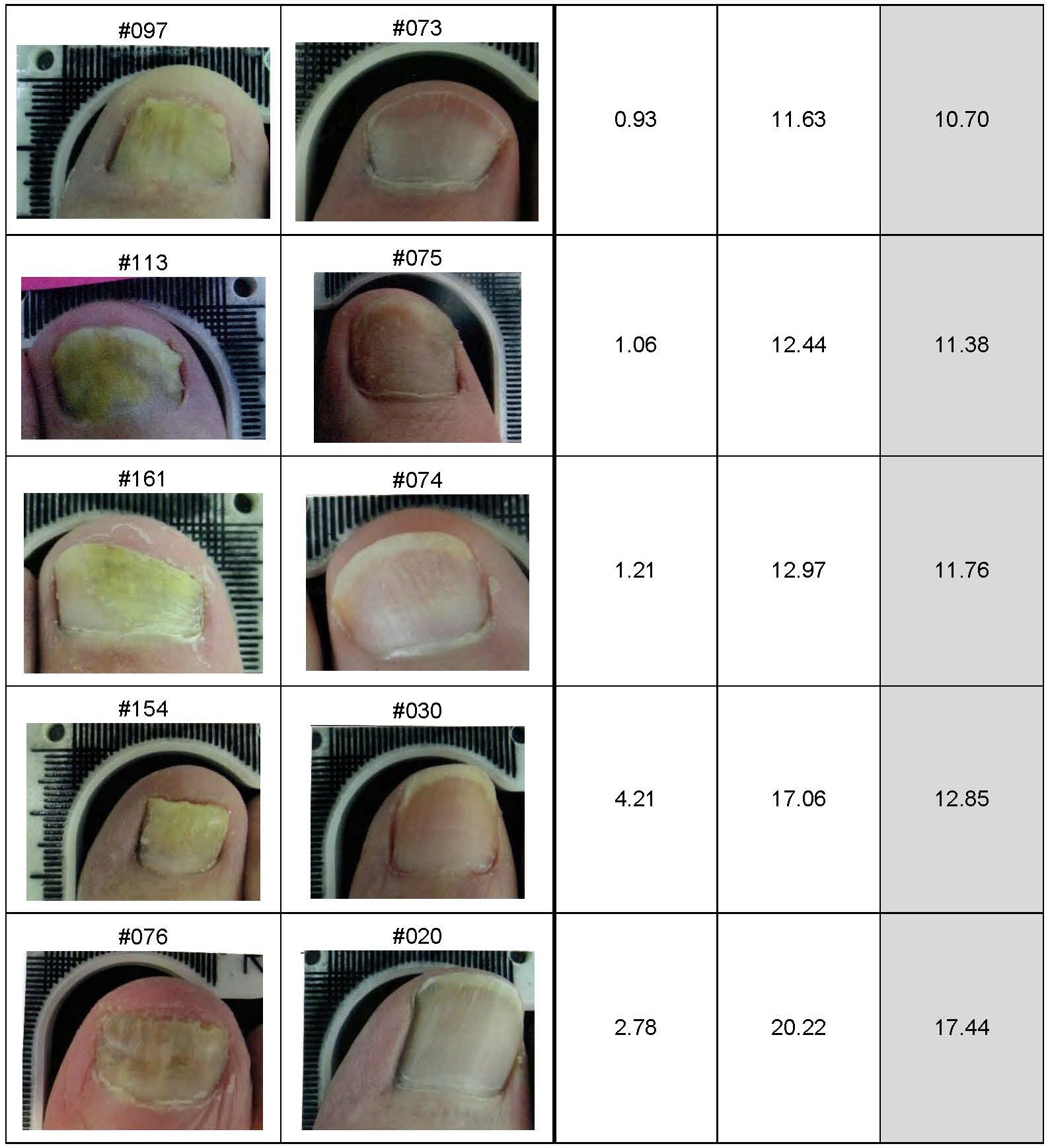 Lunula Clinical Results Summary for Press Release_Page_5