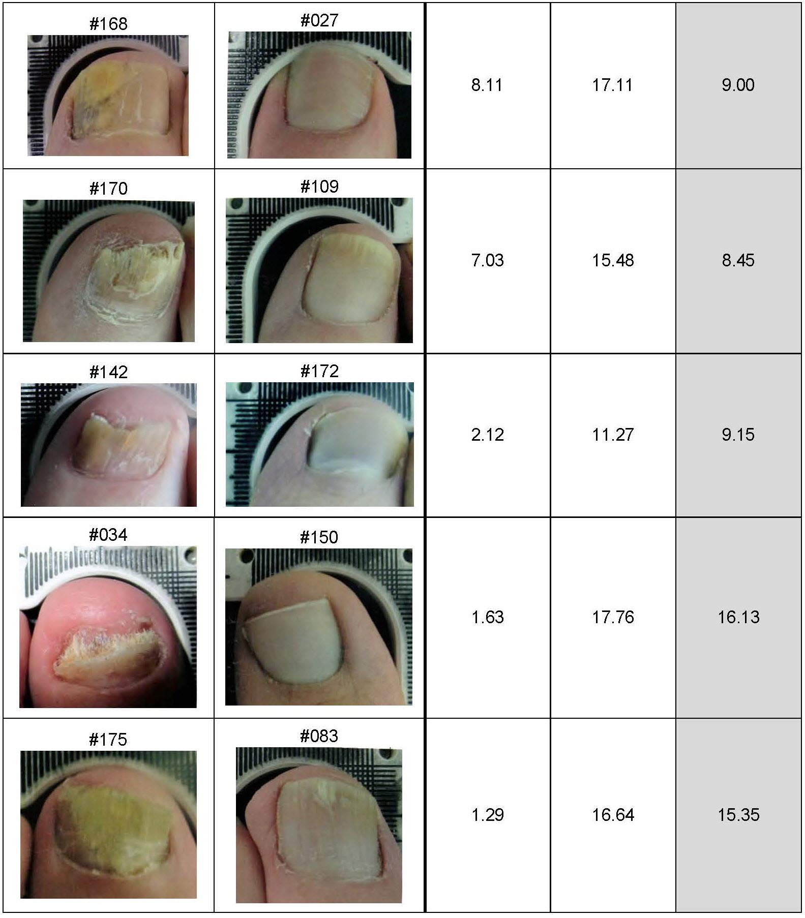 Lunula Clinical Results Summary for Press Release_Page_6