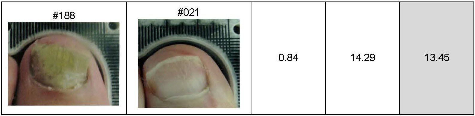 Lunula Clinical Results Summary for Press Release_Page_7